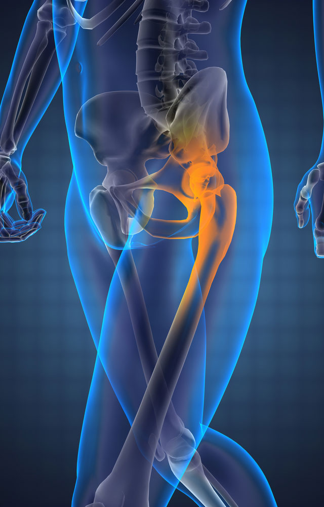 Relieve Hip Bursitis & Other Kinds Of Hip Pain