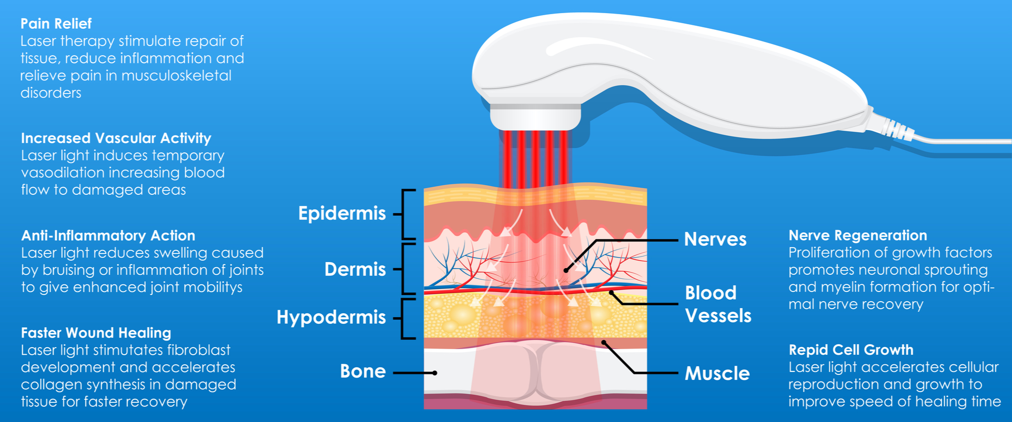 Laser Therapy graphic describing how it penetrates the body